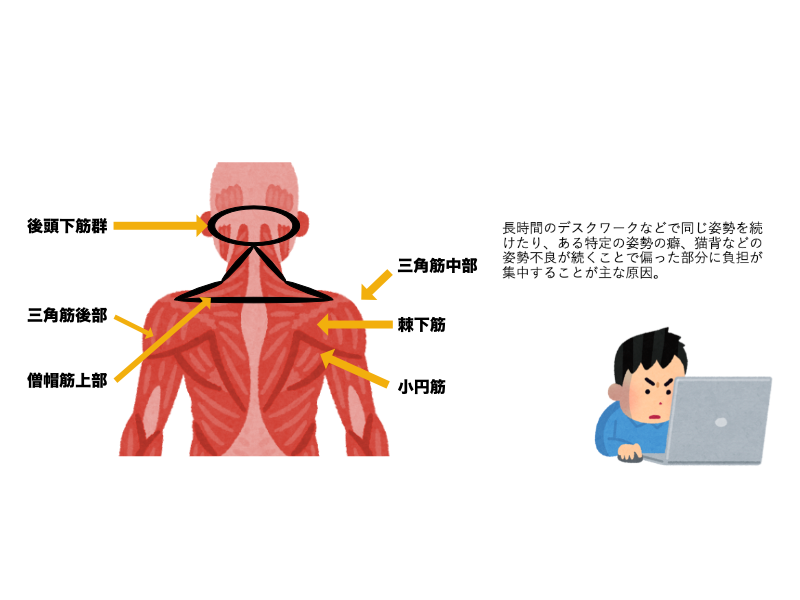 肩こり